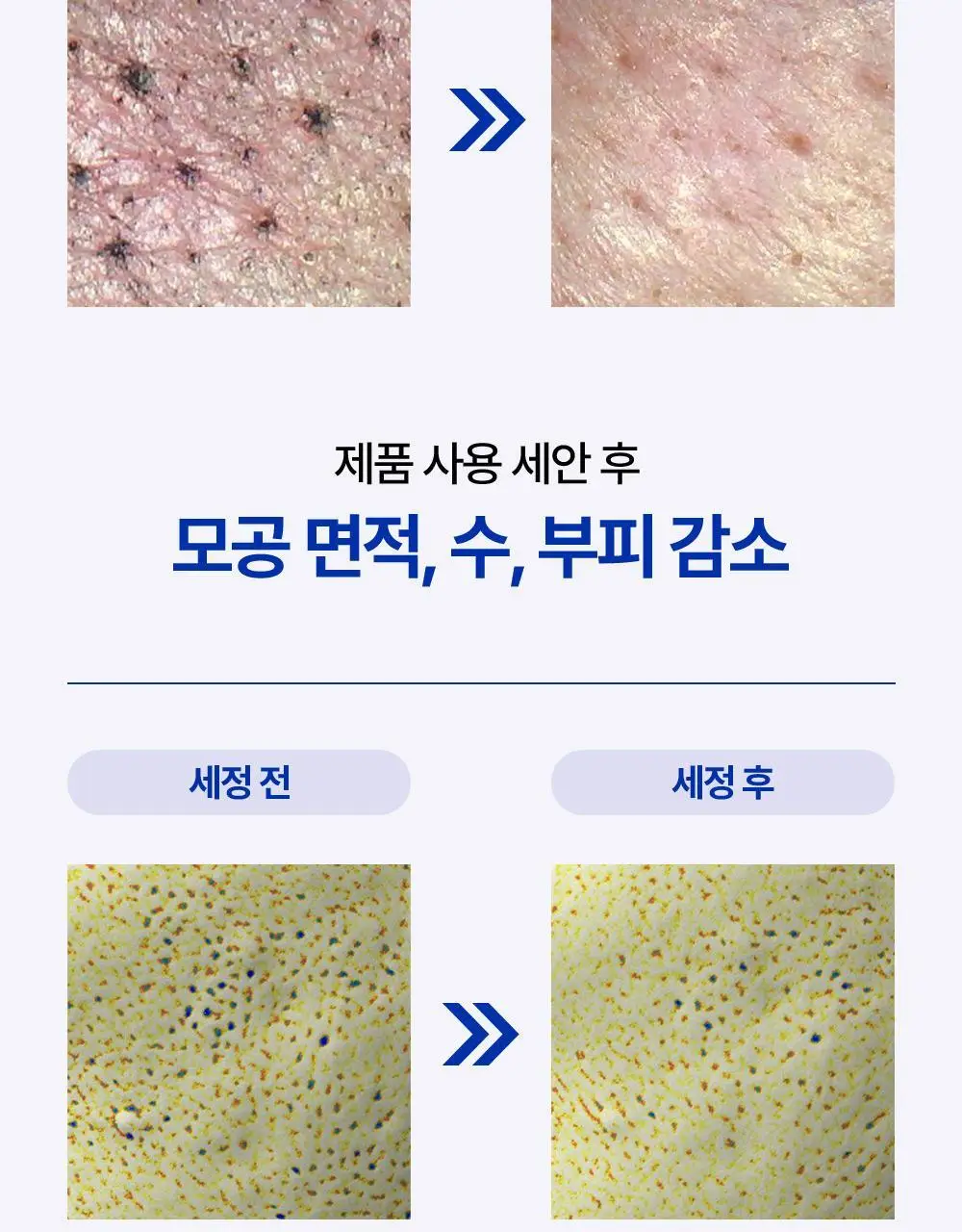 [피지개선/당김제로] 리얼베리어 익스트림 딥클렌징 블루 오일 200ml 상세페이지 17
